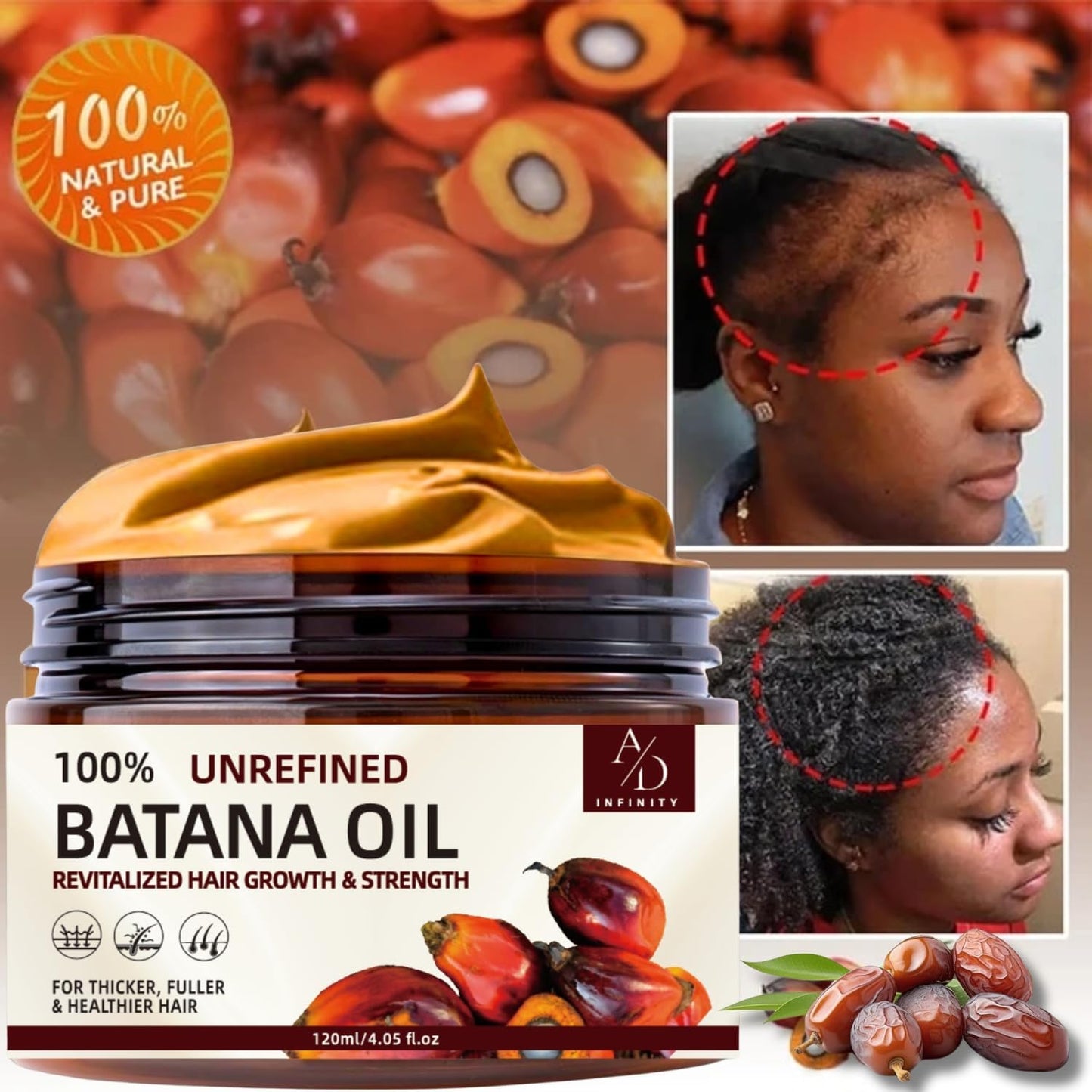 100% Unrefined Raw Batana Oil for Hair Growth Dr. Sebi Organic Pure from Honduras with Keratin, Coffee Extract & Other Ingredients to Enhance Efficacy for Thicker, Strength (Botana Oil)