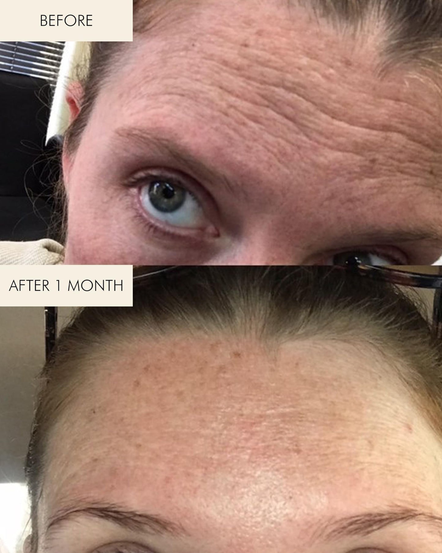 MARA - Natural Evening Primrose + Green Tea Algae Retinol Face Oil | Plant-Based Skin Care | Moisturizes + Soothes Skin To Minimizes Look of Pores + Fine Lines (Full Size, 1 fl oz | 30 ml)